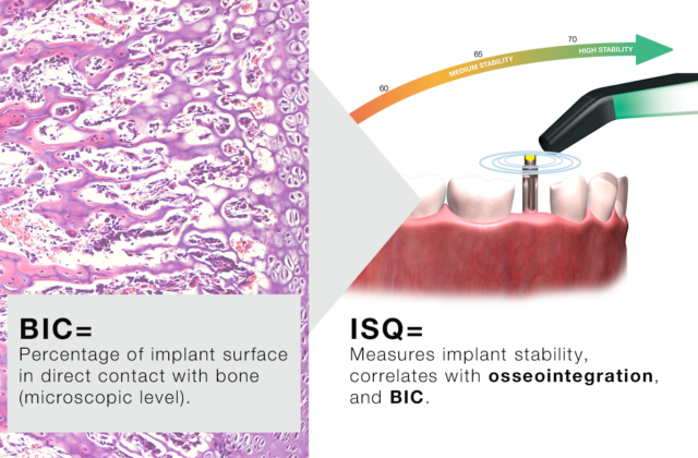 ISQ correlating to BIC