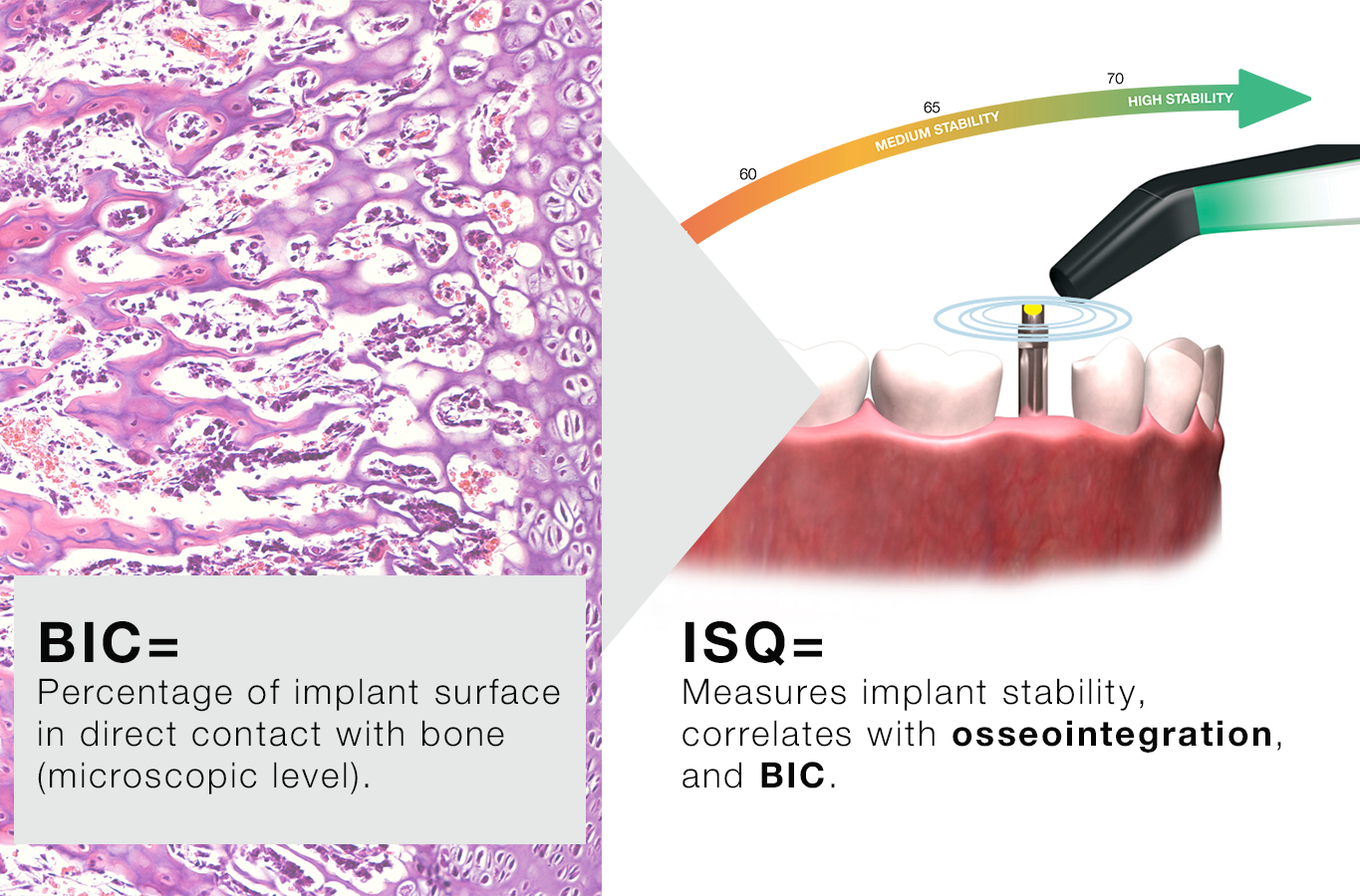 ISQ correlating to BIC