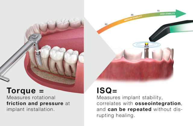 ISQ correlating to Torque