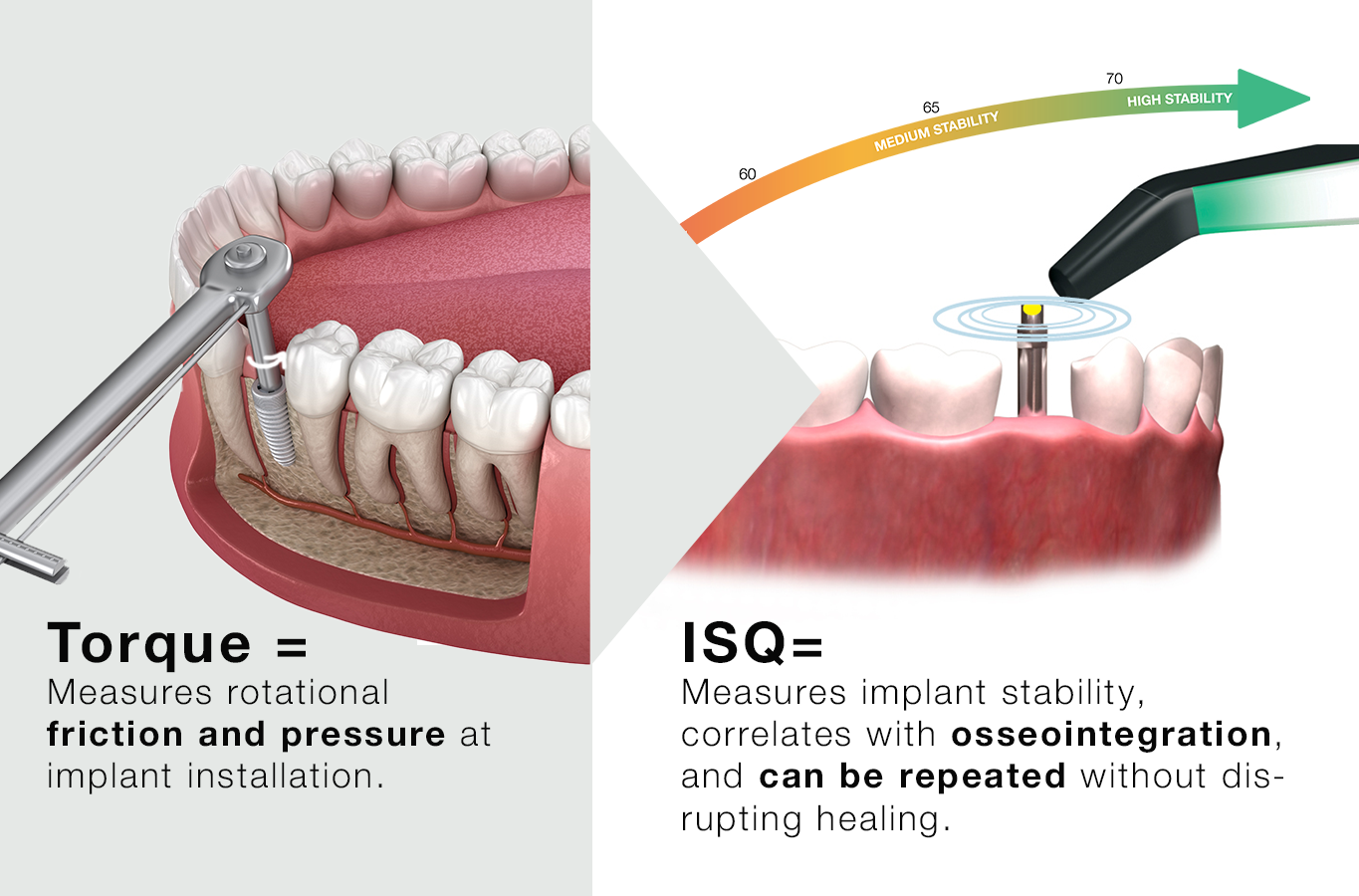 ISQ correlating to Torque