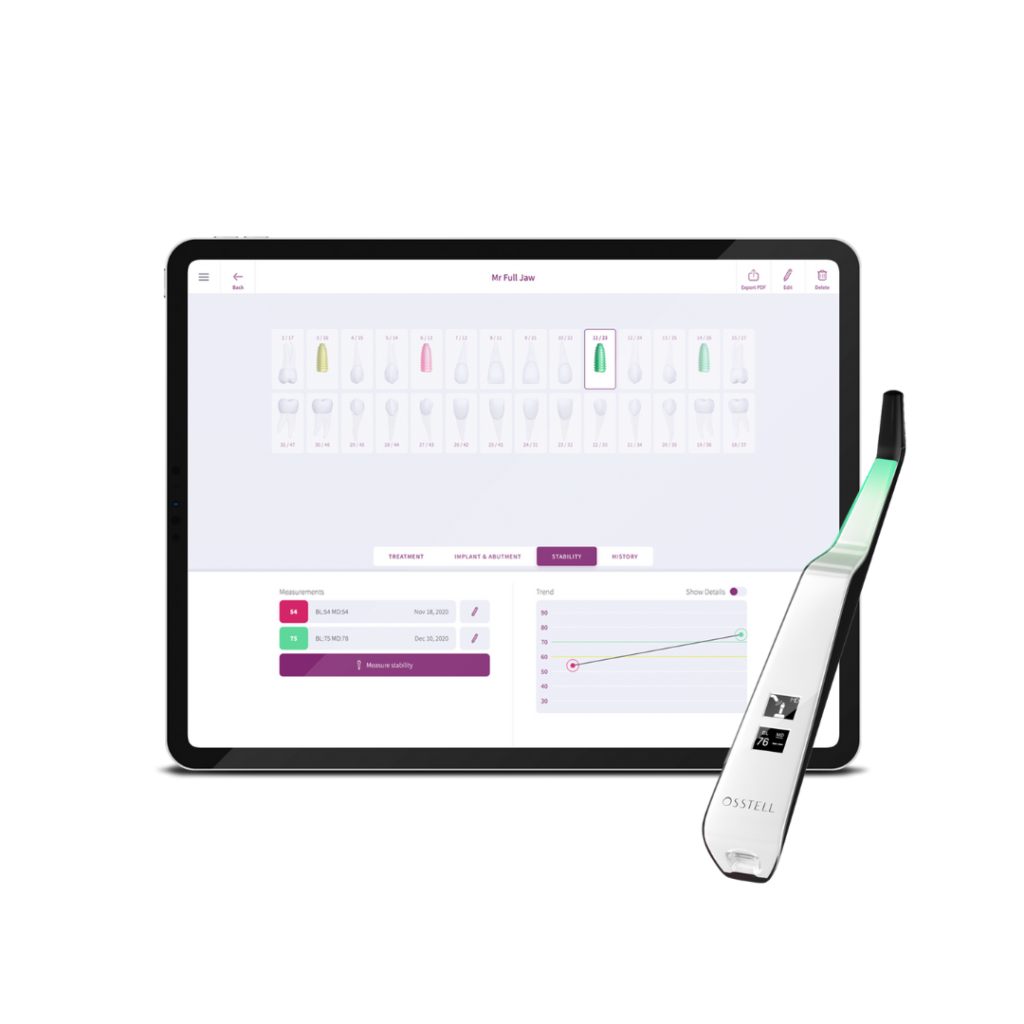 OsstellConnect and Beacon
