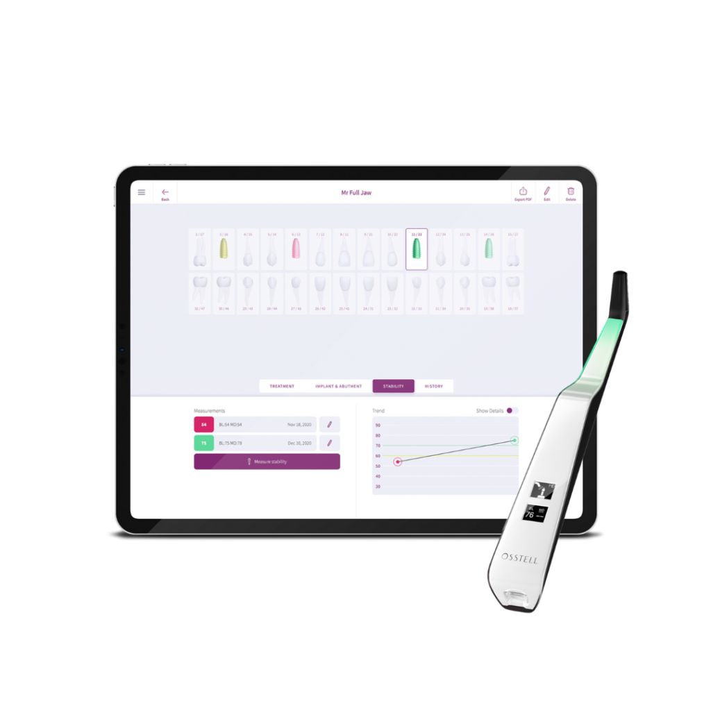 OsstellConnect and Beacon