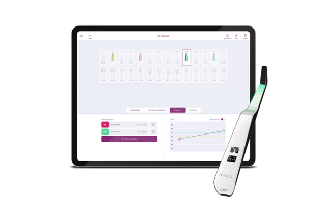 OsstellConnect and Beacon