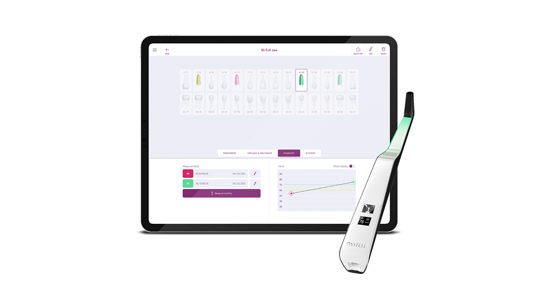 OsstellConnect and Beacon