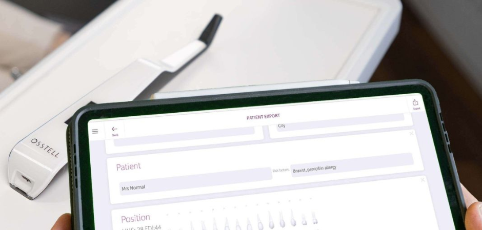 Beacon & OsstellConnect