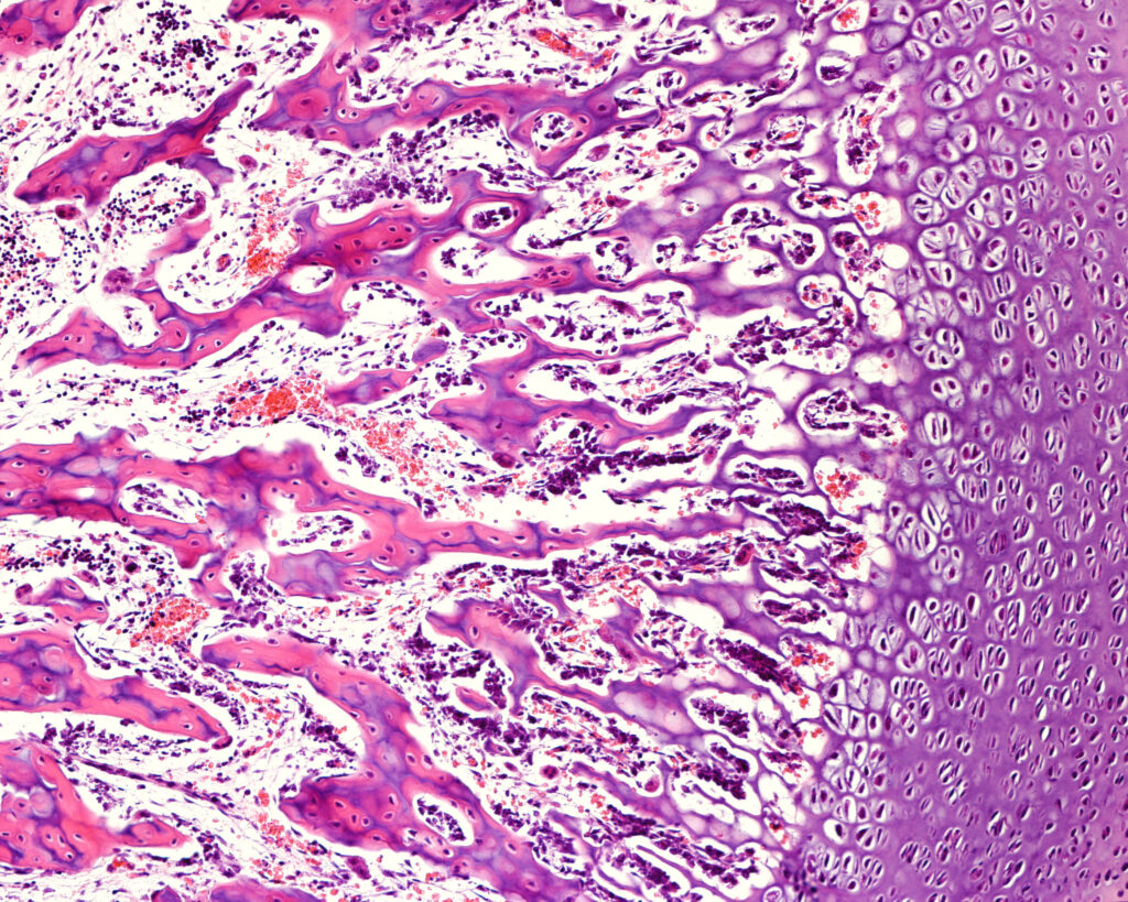 Bone cells remodelling during Osseointegration