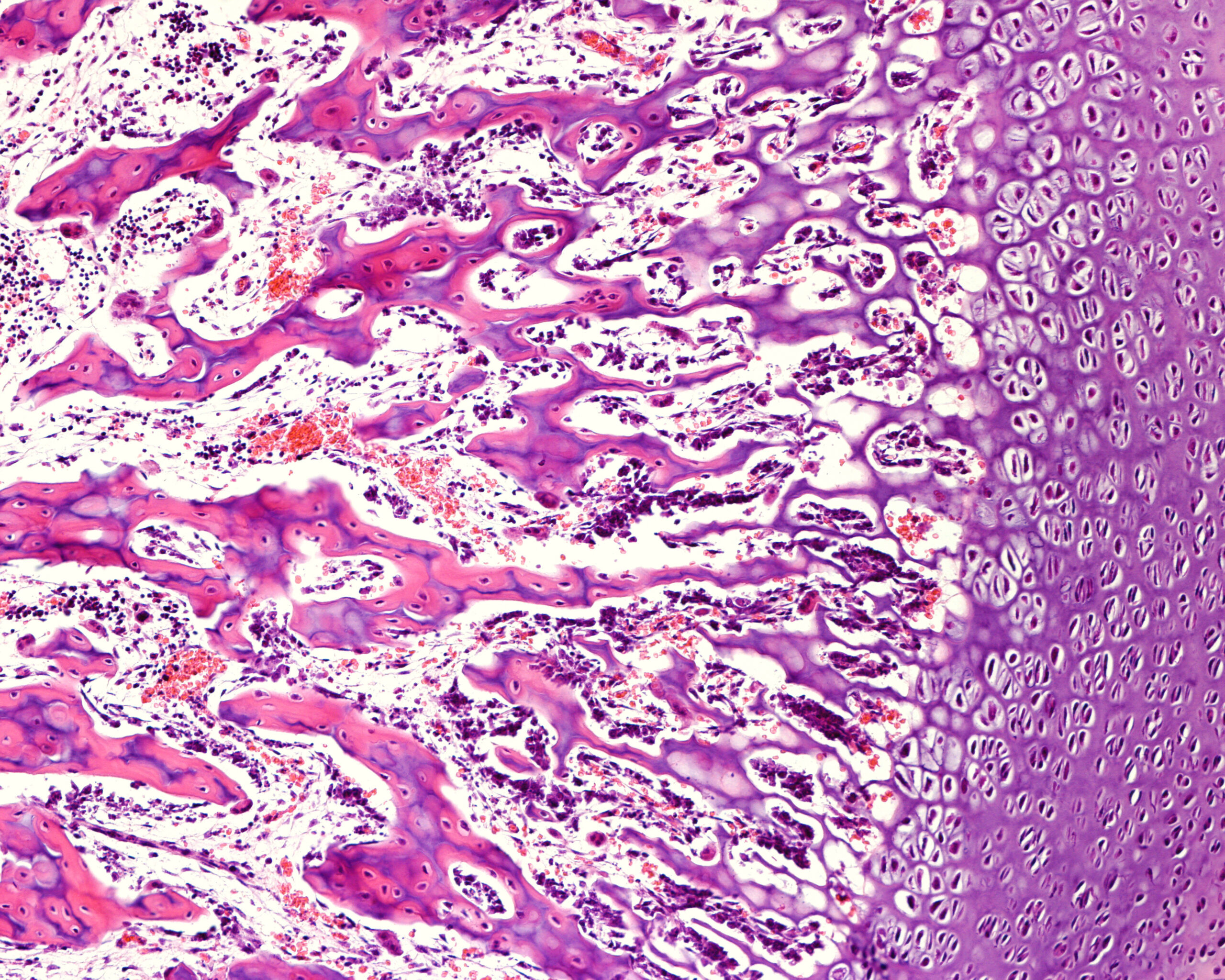 Bone cells remodelling during Osseointegration